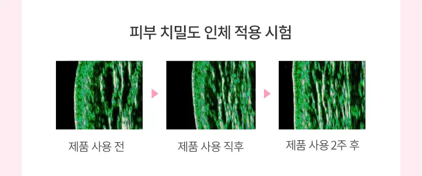 투엑스알(2X®) 콜라겐 부스터(2xr collagen booster)