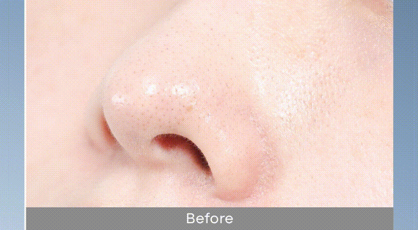 아줄렌안티블레미쉬아크네폼클렌저(AZULENE ANTI BLEMISH ACNE FOAM CLEANSER)
