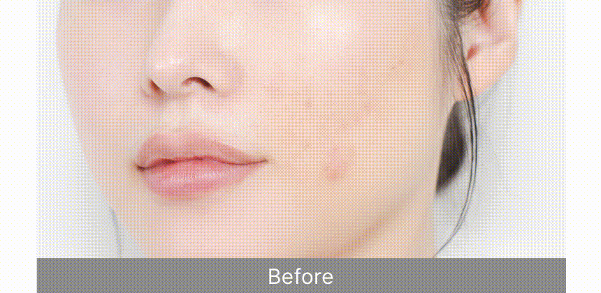 아줄렌 안티 블레미쉬 토너(azulene anti blemish toner)