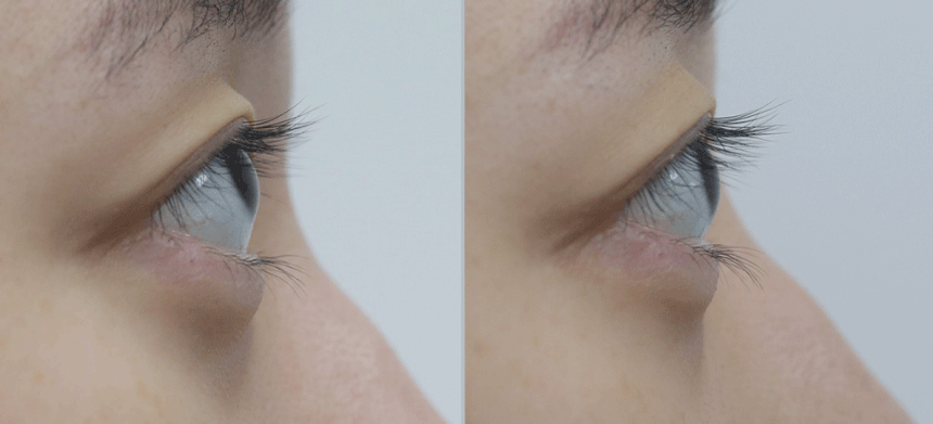 아이톤 스트롱 아이 래쉬 세럼(eye tone strong eyelash serum)