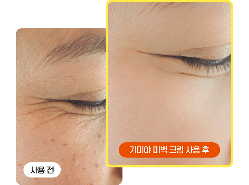 (SET) 기미야 미백크림 + 세럼 세트(gimiya whitening cream 30ml serum set)
