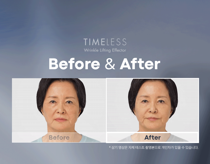 타임리스 링클 리프팅 이펙터(timeless wrinkle lifting effector)